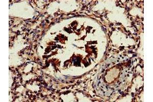 Immunohistochemistry of paraffin-embedded human lung tissue using ABIN7164755 at dilution of 1:100 (PRAS40 Antikörper  (AA 52-101))