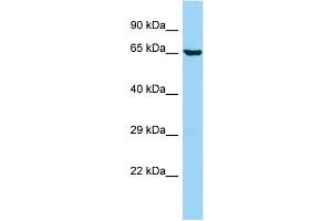 WB Suggested Anti-ANKS1B Antibody Titration: 1. (ANKS1B Antikörper  (C-Term))