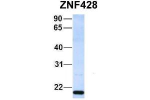 Host:  Rabbit  Target Name:  ZNF428  Sample Type:  293T  Antibody Dilution:  1. (ZNF428 Antikörper  (Middle Region))
