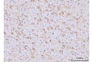 IHC analysis of RAP1GAP using anti-RAP1GAP antibody (ABIN7599729). (RAP1GAP Antikörper  (AA 11-661))