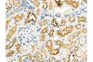 ABIN6258426 and ABIN6275705 at 1/100 staining Rat kidney tissue by IHC-P. (ZP1 Antikörper  (Internal Region))