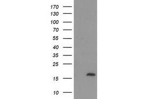Western Blotting (WB) image for anti-Chromosome 2 Open Reading Frame 40 (C2orf40) antibody (ABIN1497048) (C2orf40 Antikörper)