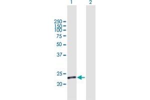 Western Blot analysis of C19orf80 expression in transfected 293T cell line by C19orf80 MaxPab polyclonal antibody. (C19ORF80 Antikörper  (AA 1-251))