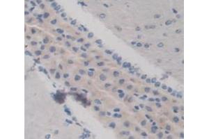 Used in DAB staining on fromalin fixed paraffin- embedded Kidney tissue (KERA Antikörper  (AA 21-292))