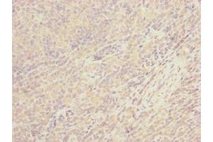 Immunohistochemistry of paraffin-embedded human tonsil tissue using ABIN7147374 at dilution of 1:100 (CEP57L1 Antikörper  (AA 1-167))