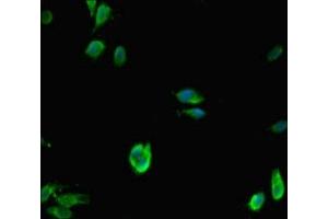 Immunofluorescent analysis of Hela cells using ABIN7158724 at dilution of 1:100 and Alexa Fluor 488-congugated AffiniPure Goat Anti-Rabbit IgG(H+L) (LSD1 Antikörper  (AA 100-150))