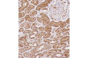 Immunohistochemical analysis of B on paraffin-embedded Human kidney tissue. (WDR41 Antikörper  (C-Term))