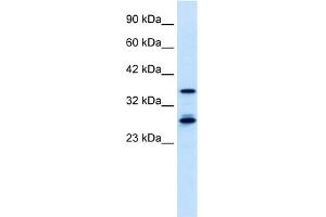 WB Suggested Anti-M96 Antibody Titration:  0. (MTF2 Antikörper  (Middle Region))