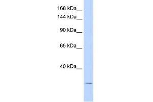WB Suggested Anti-KCNK6 Antibody Titration:  0.