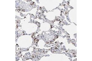 Immunohistochemical staining of human lung with ZNF77 polyclonal antibody  shows strong cytoplasmic positivity in subsets of alveolar cells. (ZNF77 Antikörper)