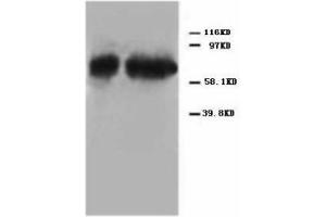 Image no. 2 for anti-Tumor Protein P73 (TP73) (C-Term) antibody (ABIN1492940) (Tumor Protein p73 Antikörper  (C-Term))