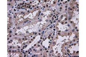 Immunohistochemical staining of paraffin-embedded thyroid tissue using anti-L1CAMmouse monoclonal antibody. (L1CAM Antikörper)