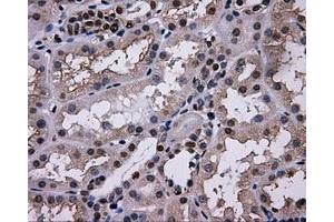 Immunohistochemical staining of paraffin-embedded thyroid tissue using anti-L1CAMmouse monoclonal antibody.
