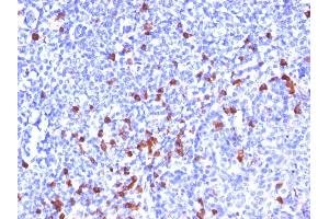 Formalin-fixed, paraffin-embedded human Tonsil stained with IgG Monoclonal Antibody (SPM556) (IGHG Antikörper)