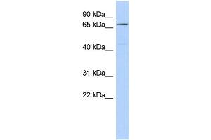 WB Suggested Anti-CLPB Antibody Titration: 0. (CLPB Antikörper  (Middle Region))