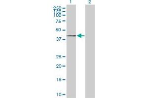 Western Blot analysis of ST3GAL1 expression in transfected 293T cell line by ST3GAL1 MaxPab polyclonal antibody. (ST3GAL1 Antikörper  (AA 1-340))