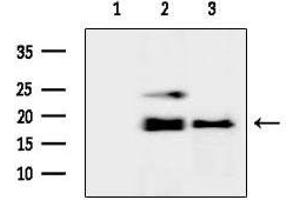 anti-Ribosomal Protein S19 (RPS19) (Internal Region) antibody