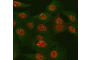 IF analysis of TULP3 using anti-TULP3 antibody (ABIN7602191) and anti-Tubulin Alpha antibody (ABIN7600339). (TULP3 Antikörper  (AA 62-362))