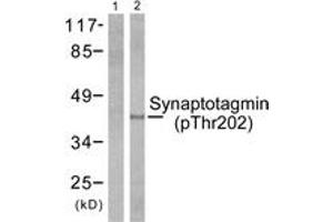 Western blot analysis of extracts from 293 cells treated with Forskolin 40nM 30', using Synaptotagmin (Phospho-Thr202) Antibody. (Synaptotagmin Antikörper  (pThr202))