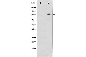 Western blot analysis of HDAC6 expression in HepG2 whole cell lysates,The lane on the left is treated with the antigen-specific peptide. (HDAC6 Antikörper  (N-Term))