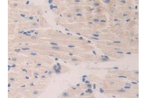 IHC-P analysis of Mouse Heart Tissue, with DAB staining. (CTSA Antikörper  (AA 215-470))