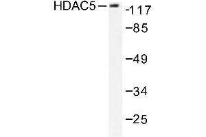 Image no. 2 for anti-Histone Deacetylase 5 (HDAC5) antibody (ABIN265457) (HDAC5 Antikörper)