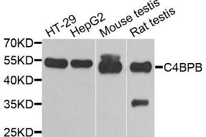 Western blot analysis of extracts of various cells, using C4BPB antibody. (C4BPB Antikörper)