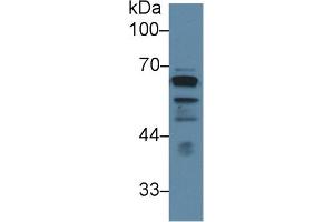 Detection of LCAT in Human PC3 cell lysate using Polyclonal Antibody to Lecithin Cholesterol Acyltransferase (LCAT) (LCAT Antikörper  (AA 290-432))