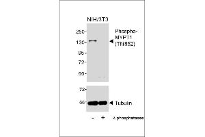 Western blot analysis of lysates from NIH/3T3 cell line, untreated or treated with λ phosphatases, 30 min, using Phospho-MYPT1 (Thr852) Antibody (upper) or Tubulin (lower). (PPP1R12A Antikörper  (pThr852))