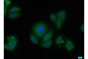 Immunofluorescence staining of HepG2 cells with ABIN7144476 at 1:50, counter-stained with DAPI. (AIFM2 Antikörper  (AA 110-373))
