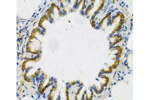 Immunohistochemistry of paraffin-embedded Rat lung using AK1 Polyclonal Antibody at dilution of 1:100 (40x lens). (Adenylate Kinase 1 Antikörper)