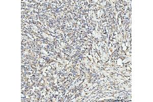 IHC analysis of EDC4 using anti-EDC4 antibody (ABIN7599694). (EDC4 Antikörper  (AA 1082-1388))