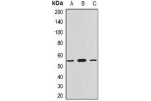 Western blot analysis of Myotilin expression in HepG2 (A), mouse heart (B), rat heart (C) whole cell lysates.