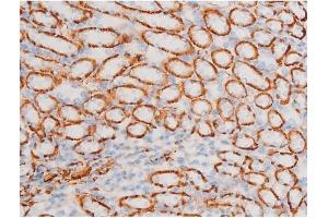 Immunohistochemistry (IHC) image for anti-Spleen tyrosine Kinase (SYK) (pTyr348) antibody (ABIN6255895)