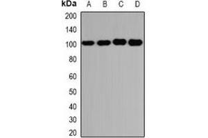 Western blot analysis of GLUR3 expression in U251 (A), PC3 (B), mouse brain (C), mouse lung (D) whole cell lysates. (Glutamate Receptor 3 Antikörper)