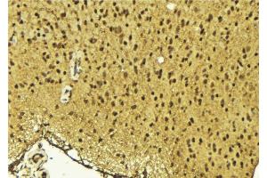ABIN6275645 at 1/100 staining Mouse brain tissue by IHC-P. (TSEN54 Antikörper  (Internal Region))