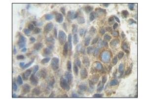 Image no. 1 for anti-Placenta Growth Factor (PGF) antibody (ABIN181639) (PLGF Antikörper)