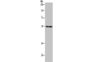 Western Blotting (WB) image for anti-IMP (Inosine 5'-Monophosphate) Dehydrogenase 2 (IMPDH2) antibody (ABIN2423659) (IMPDH2 Antikörper)