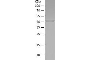 SOX2 Protein (AA 129-317) (His-IF2DI Tag)