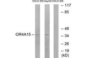 Western blot analysis of extracts from COLO/HepG2 cells, using OR4A15 Antibody.