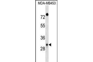 DP1 Antibody (C-term) 17383b western blot analysis in MDA-M cell line lysates (35 μg/lane). (DAPP1 Antikörper  (C-Term))
