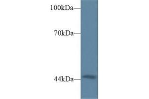 Detection of TRDN in Mouse Heart lysate using Polyclonal Antibody to Triadin (TRDN) (Triadin Antikörper  (AA 486-687))