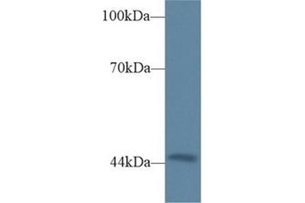 Triadin anticorps  (AA 486-687)