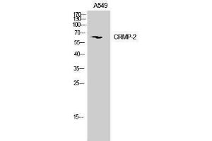 Western Blotting (WB) image for anti-Dihydropyrimidinase-Like 2 (DPYSL2) (Ser306), (Ser309) antibody (ABIN3179981) (DPYSL2 Antikörper  (Ser306, Ser309))
