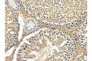 ABIN6257331 and ABIN6275242 at 1/100 staining rat testis tissue by IHC-P. (MRPL3 Antikörper  (N-Term))