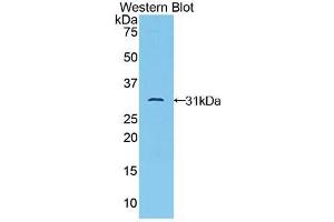 Western blot analysis of the recombinant protein. (TAB1 Antikörper  (AA 189-439))