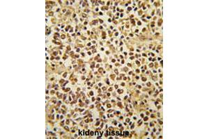 Formalin-fixed and paraffin-embedded human kidney tissue reacted with SNAI1 polyclonal antibody  , which was peroxidase-conjugated to the secondary antibody, followed by AEC staining. (SNAIL Antikörper  (AA 9-39))