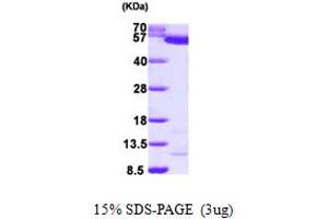 Pyruvate Kinase, Liver and RBC (PKLR) (AA 47-574) (Active) protein (His tag)