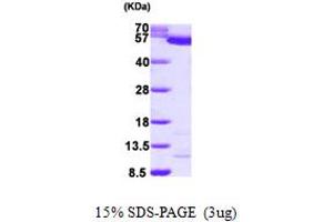 SDS-PAGE (SDS) image for Pyruvate Kinase, Liver and RBC (PKLR) (AA 47-574) protein (His tag) (ABIN667822) (PKLR Protein (AA 47-574) (His tag))