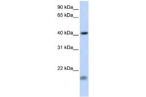 WB Suggested Antibody Titration: 0. (SHOX2 Antikörper  (Middle Region))